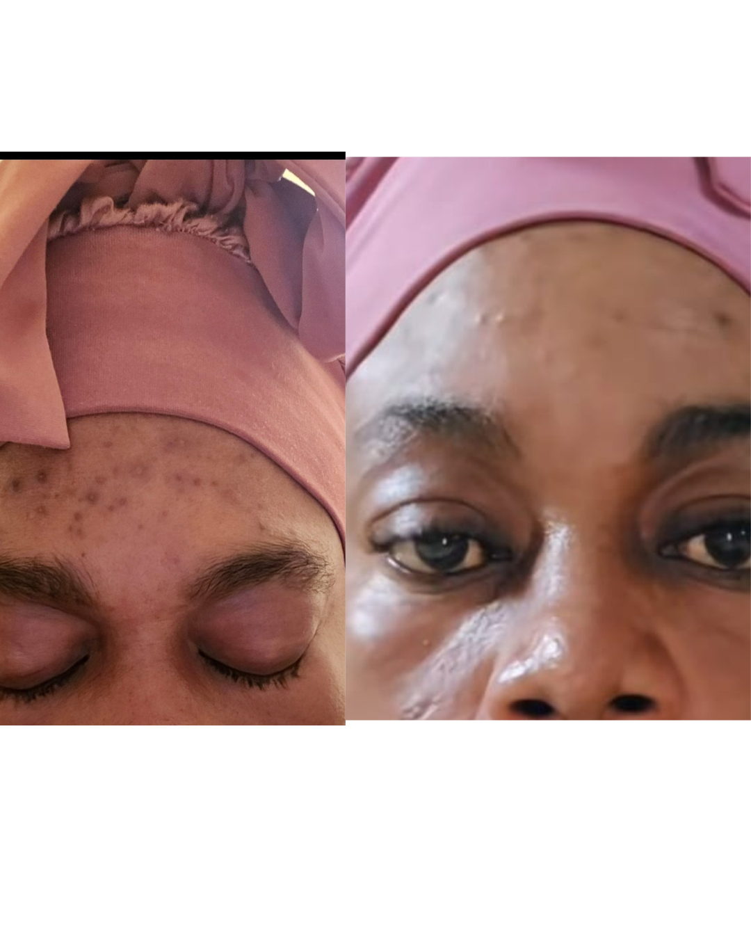 Skin Revival Treatment