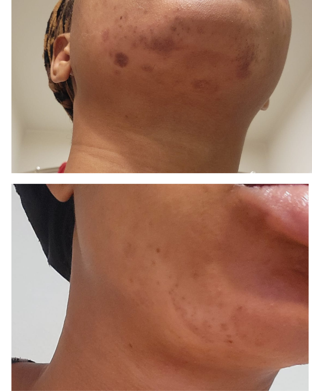 Skin Revival Treatment
