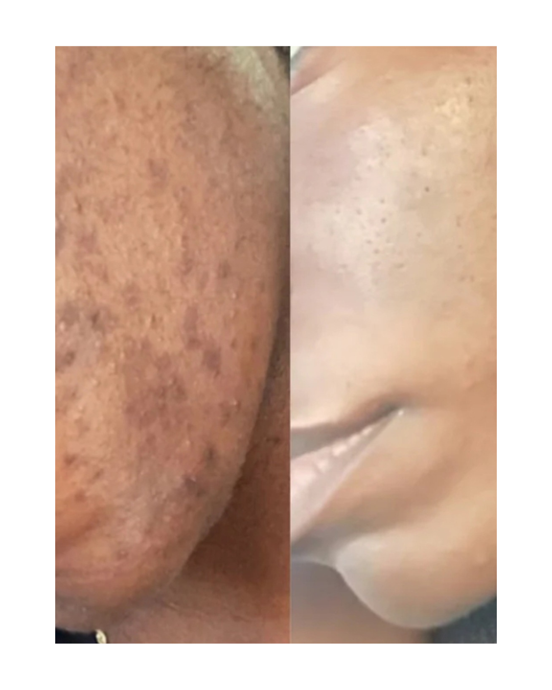 Skin Revival Treatment