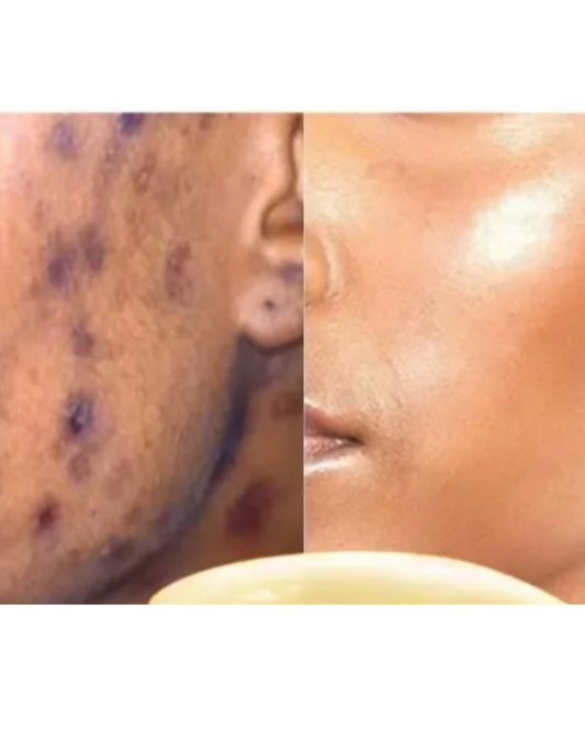 Skin Revival Treatment