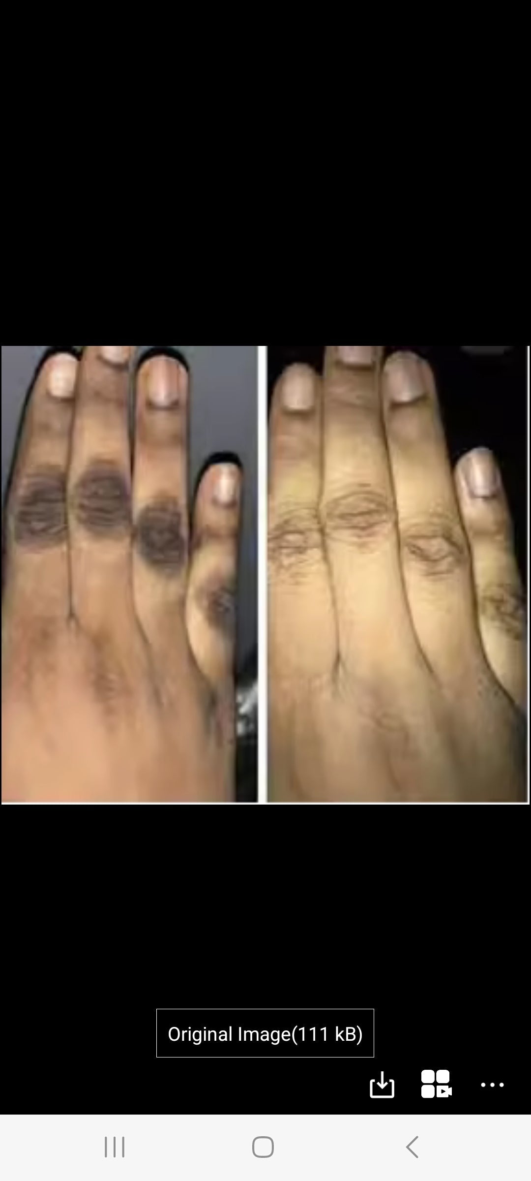 Before and after