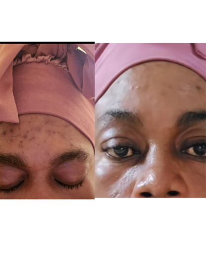 Skin Revival Treatment